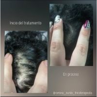 RZ tricologia cosmética estética: el cuidado real de la salud y belleza capilar