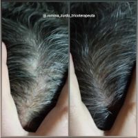 RZ tricologia cosmética estética: el cuidado real de la salud y belleza capilar