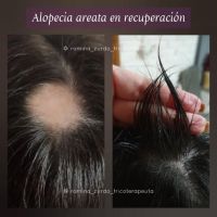 RZ tricologia cosmética estética: el cuidado real de la salud y belleza capilar