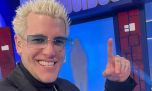 Qué le pasa a la dentadura de Alex Caniggia