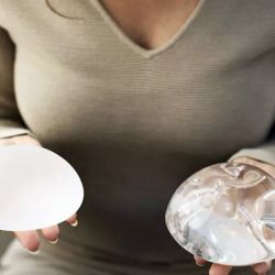 Implantes mamarios | Foto:CEDOC