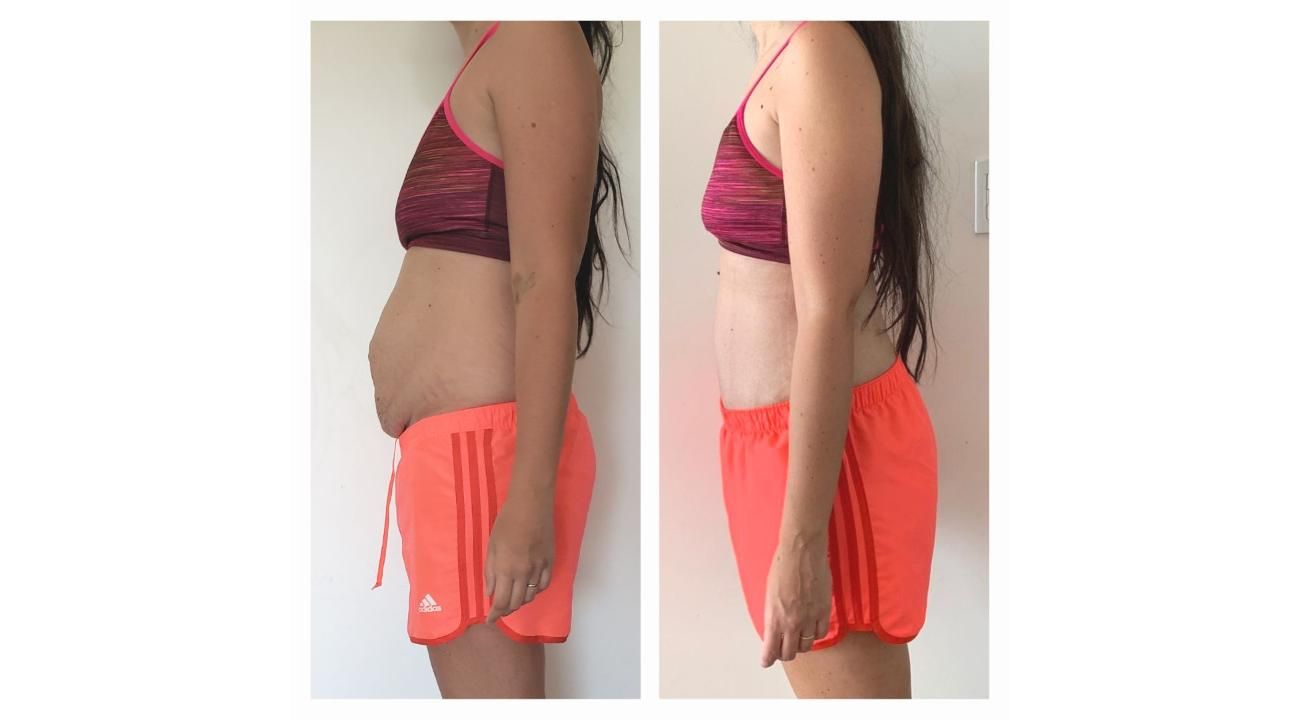 Proyecto Abdomen: La fusión entre la kinesiología y el entrenamiento es la clave del éxito en la rehabilitación de la diástasis abdominal