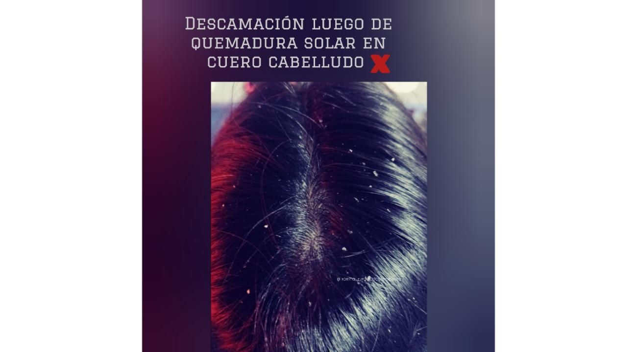 Especialista en el cuidado real del cuero cabelludo y cabello