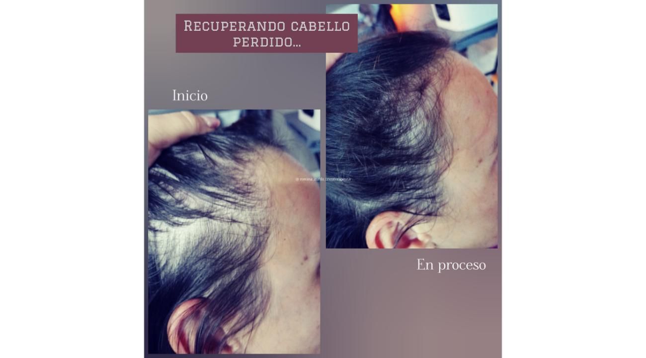 Especialista en el cuidado real del cuero cabelludo y cabello