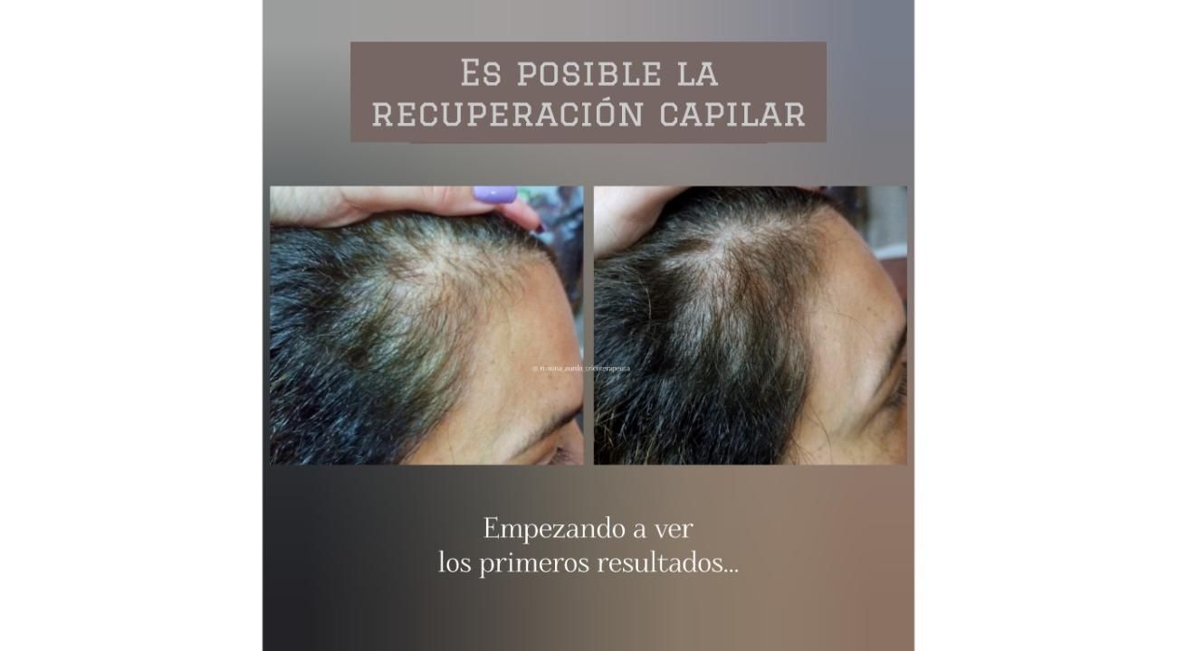 Especialista en el cuidado real del cuero cabelludo y cabello