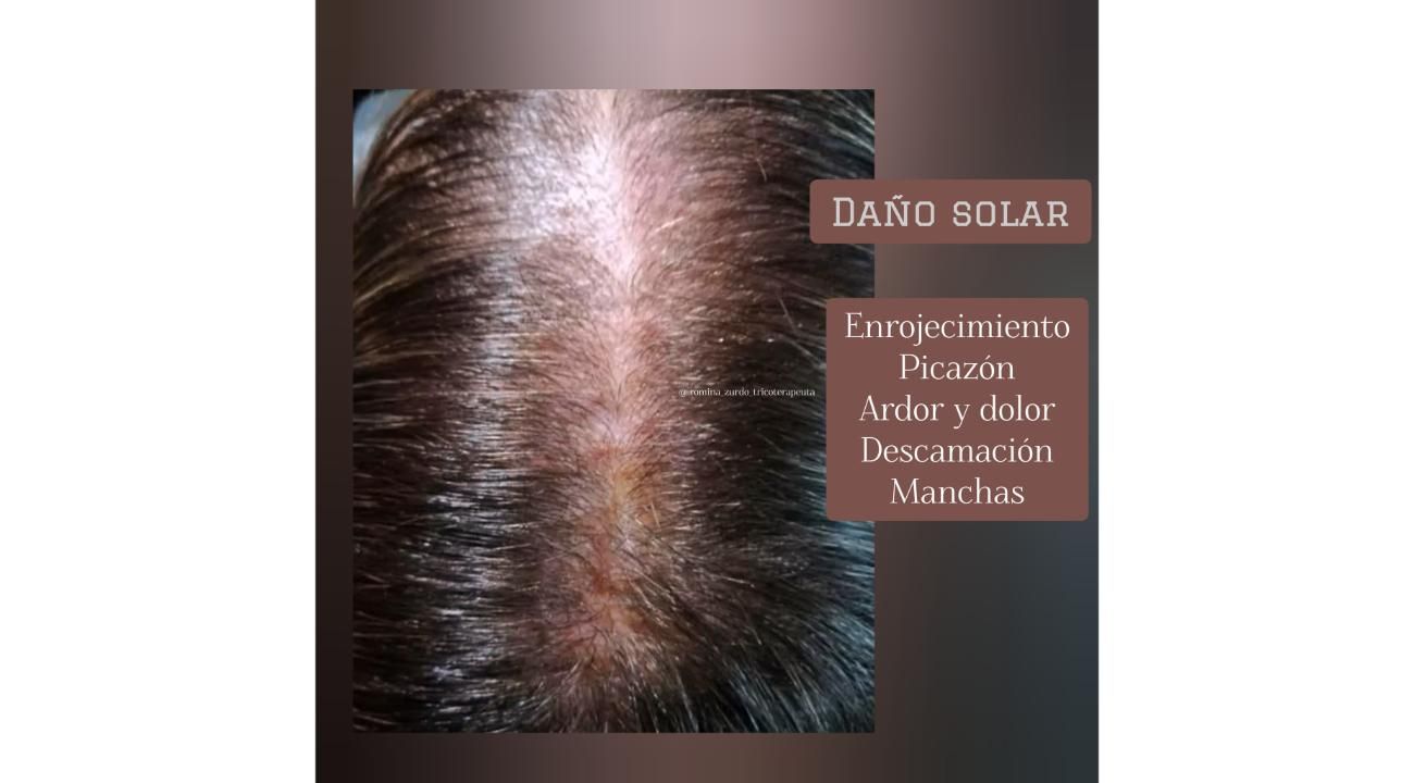 Especialista en el cuidado real del cuero cabelludo y cabello