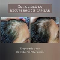 Especialista en el cuidado real del cuero cabelludo y cabello