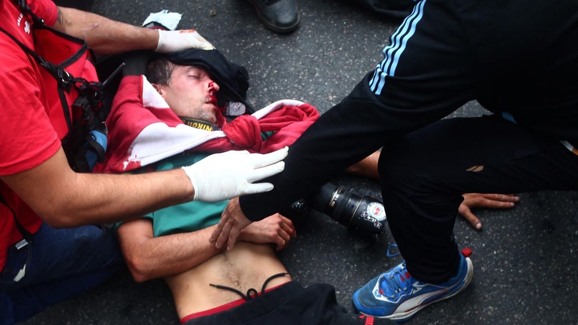 Argentine photojournalist Pablo Grillo receives medical treatment by paramedics after being injured during a protest of pensioners supported by football fans against the government of President Javier Milei in Buenos Aires on March 12, 2025.