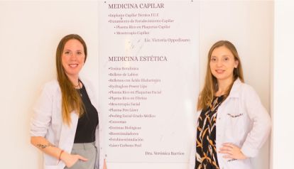 Implante capilar: Todo lo que tenes que saber antes de tomar la decisión
