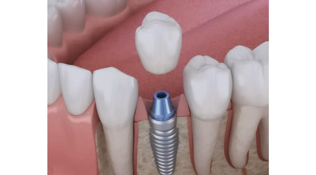 Una mirada diferente hacia la nueva odontología.