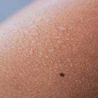 La Importancia de la Hidratación en la Piel: El Secreto para una Piel Radiante y Saludable