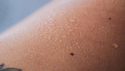 La Importancia de la Hidratación en la Piel: El Secreto para una Piel Radiante y Saludable