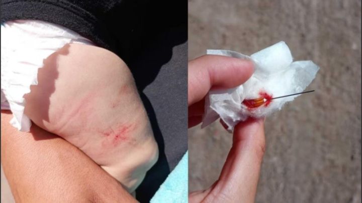Llevó a vacunar a su bebé y le dejaron la aguja clavada.