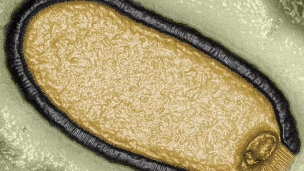 virus del Mamut20250416