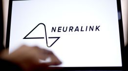 Musk Says First Neuralink Patient Received Implant In Brain 