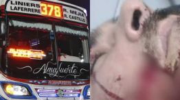 Ataque a un colectivero en La Matanza 20250428
