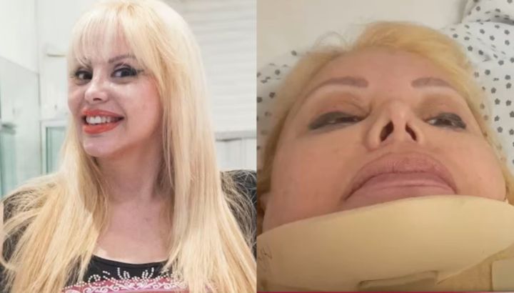 Flavia Miller fue atropellada por un auto y se golpeó la cabeza contra el asfalto: "Volé por el aire"