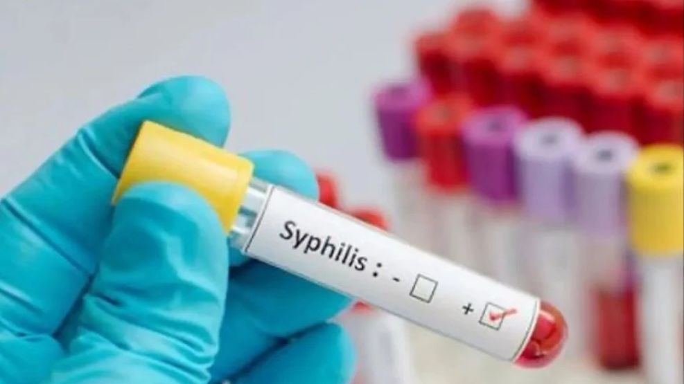 Aumentan los casos de reinfección de sífilis en la Argentina y hay alerta.