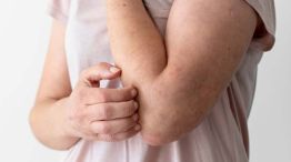 enfermedad viral20250529