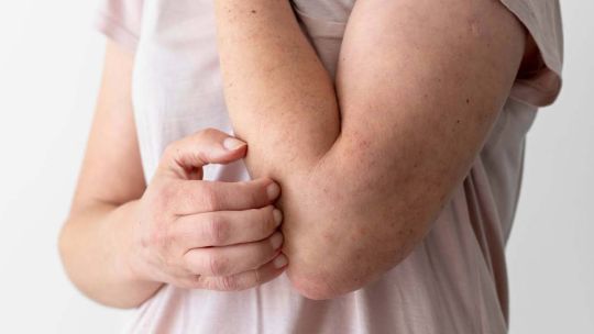 enfermedad viral20250529