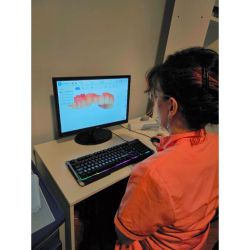 Coral Odontología: “Implantes y coronas: soluciones duraderas para recuperar funcionalidad y estética” | Foto:CEDOC