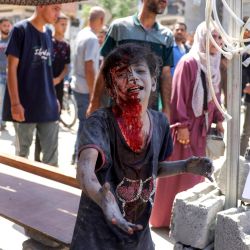 Un palestino herido reacciona tras ser rescatado de los escombros de la casa de la familia Shaheen, que fue blanco de un ataque israelí en el barrio de Saftawi, al oeste de Jabalia, en el norte de la Franja de Gaza. | Foto:Bashar Taleb / AFP
