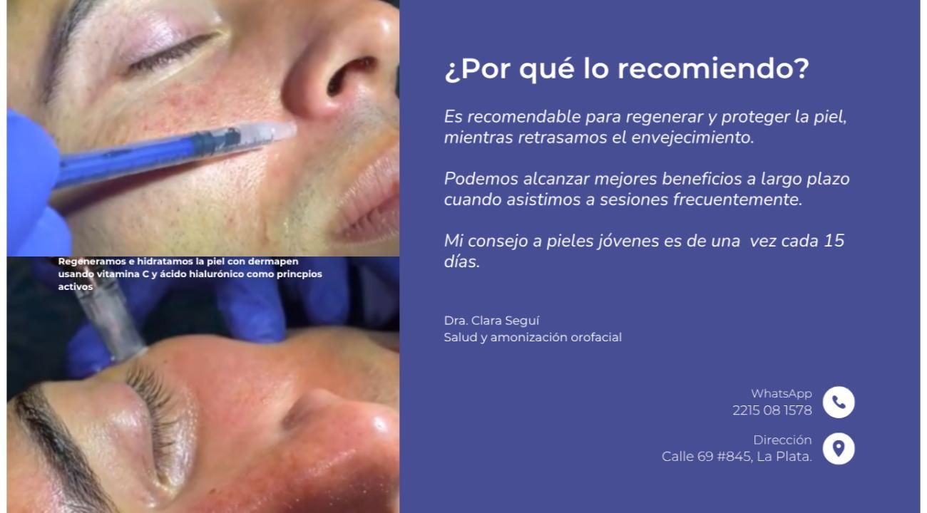 El Dermapen en los tratamientos de armonización orofacial: una revolución en el cuidado de la piel