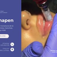 El Dermapen en los tratamientos de armonización orofacial: una revolución en el cuidado de la piel