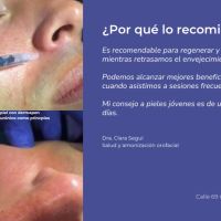 El Dermapen en los tratamientos de armonización orofacial: una revolución en el cuidado de la piel