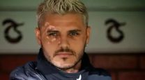 Mauro Icardi