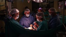 operacion pionera en el Garrahan