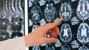 Neurocirujanos