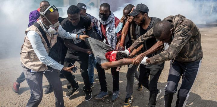 Manifestantes cargan a un hombre gravemente herido mientras intentan evacuarlo entre nubes de gas lacrimógeno disparadas por agentes de la Policía de Kenia, mientras estallan enfrentamientos durante una manifestación por la muerte del bloguero keniano Albert Ojwang, quien falleció bajo custodia policial, en el centro de Nairobi.