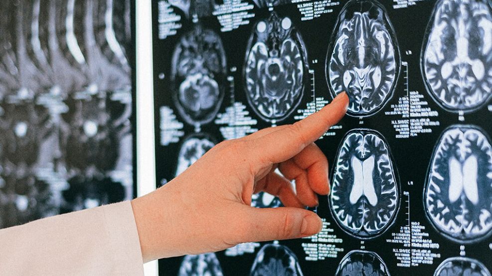 Neurocirujanos