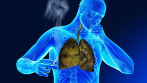 Enfermedades Respiratorias