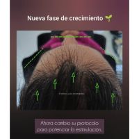 Tu cabello habla: aprendé a escuchar lo que dice sobre tu salud.