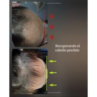 Tu cabello habla: aprendé a escuchar lo que dice sobre tu salud.