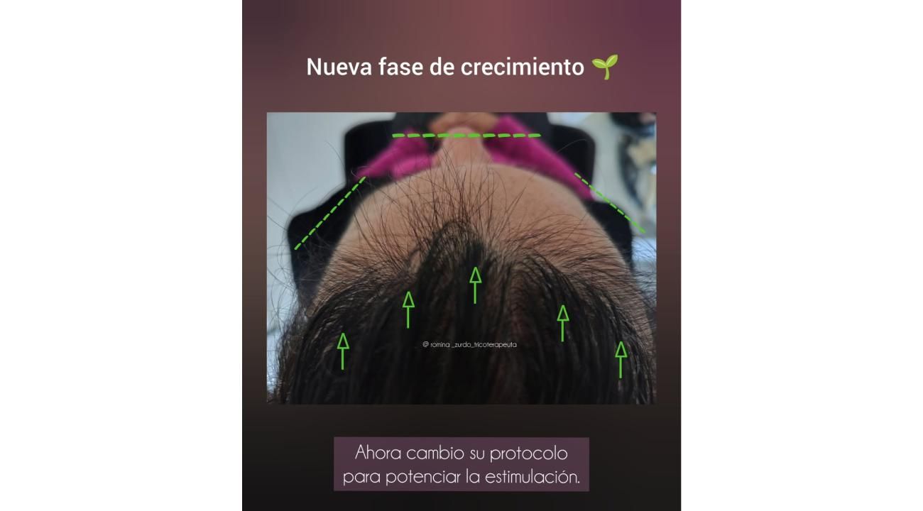 Tu cabello habla: aprendé a escuchar lo que dice sobre tu salud.