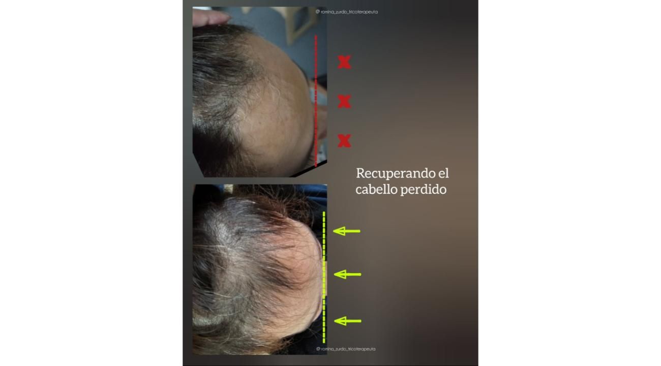 Tu cabello habla: aprendé a escuchar lo que dice sobre tu salud.