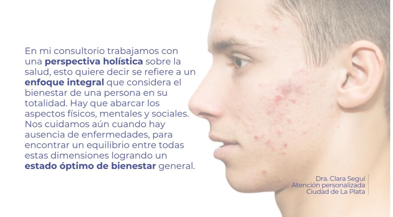Cicatrices de acné: causas y tratamientos innovadores para recuperar la piel
