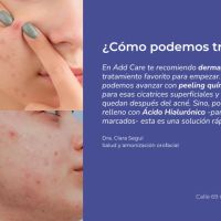 Cicatrices de acné: causas y tratamientos innovadores para recuperar la piel