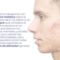 Cicatrices de acné: causas y tratamientos innovadores para recuperar la piel