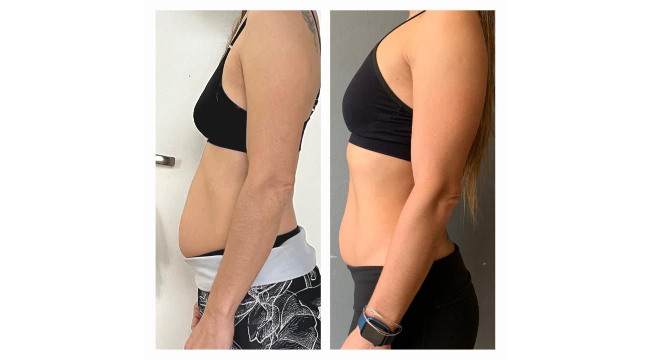 Proyecto Abdomen: La “Pancita Postural” Cuando el abdomen habla de tu postura.