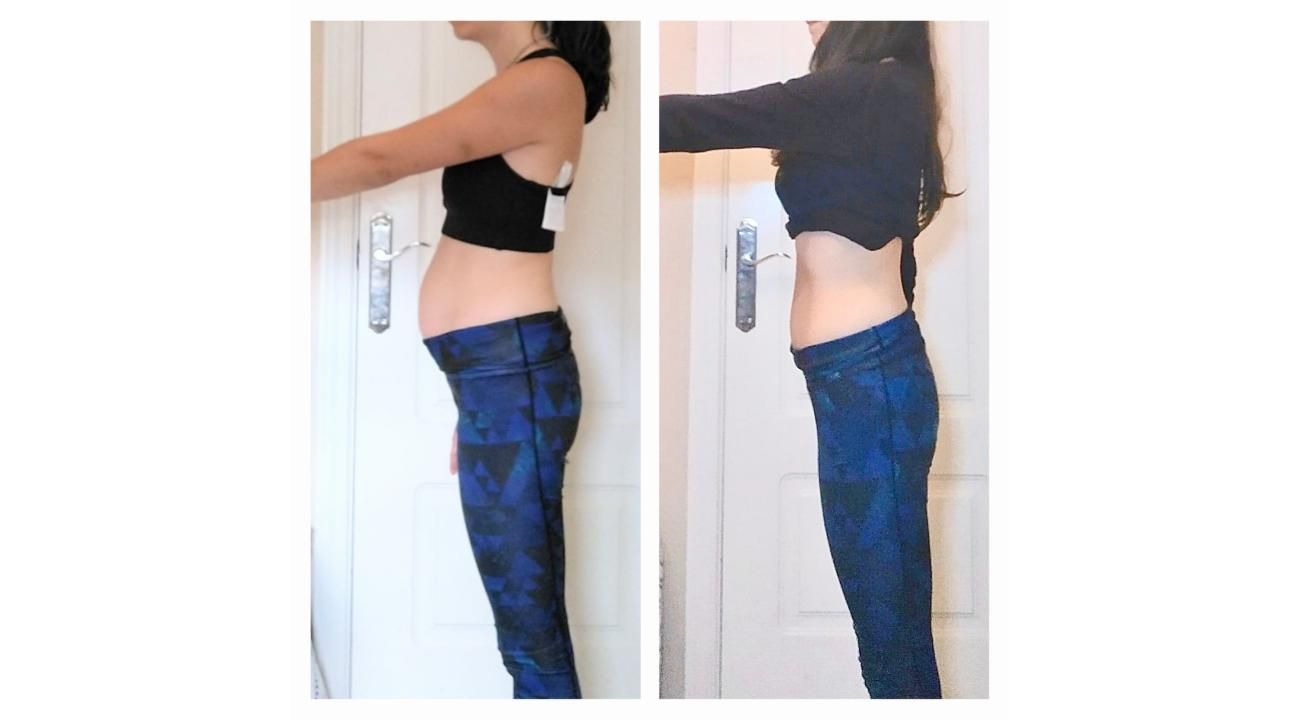 Proyecto Abdomen: La “Pancita Postural” Cuando el abdomen habla de tu postura.