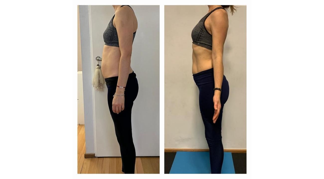 Proyecto Abdomen: La “Pancita Postural” Cuando el abdomen habla de tu postura.