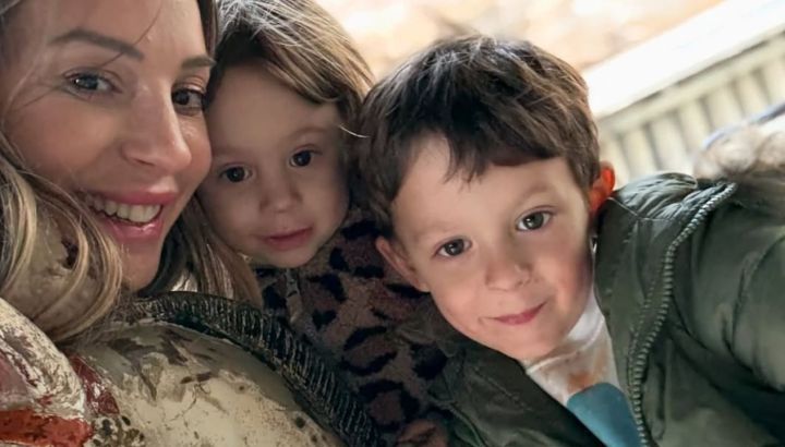 Noelia Marzol mostró las heridas de su hijo tras el accidente que sufrió