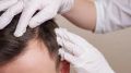 Descubren una molécula que hace crecer el pelo.