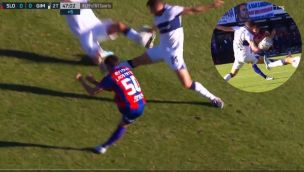 Polemica SLO GIM