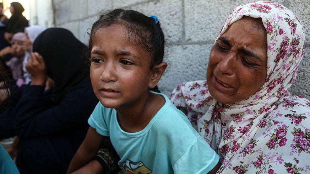 Desnutrición en Gaza 24072025