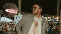 Jusin Timberlake tiene la enfermedad de Lyme